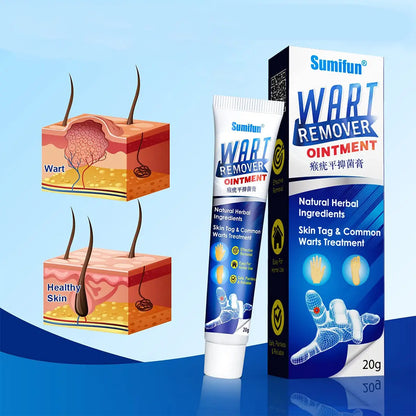 كريم ازالة وعلاج الزوائد الجلدية ( الثآليل )