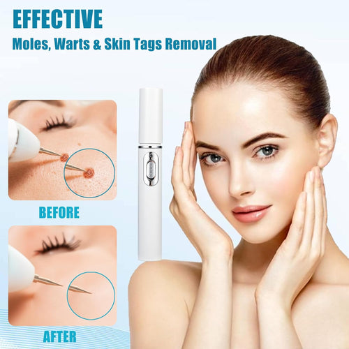 أداة العناية بالبشرة لإزالة الثآليل بالضوء الأزرق